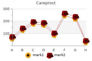 order careprost 3ml with mastercard