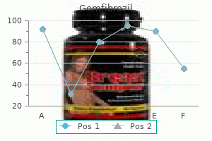 buy 300mg gemfibrozil with mastercard