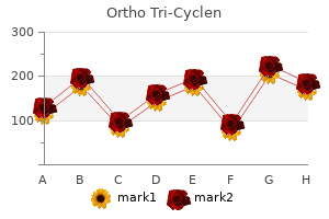 ortho tri-cyclen 50 mg sale