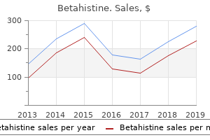 order betahistine 16mg with mastercard