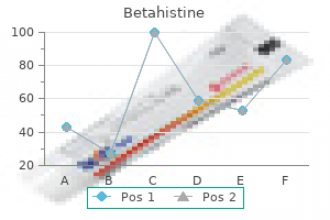 purchase 16mg betahistine visa