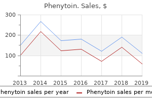 100 mg phenytoin free shipping