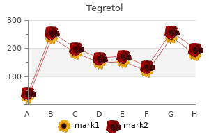 generic tegretol 100mg on-line